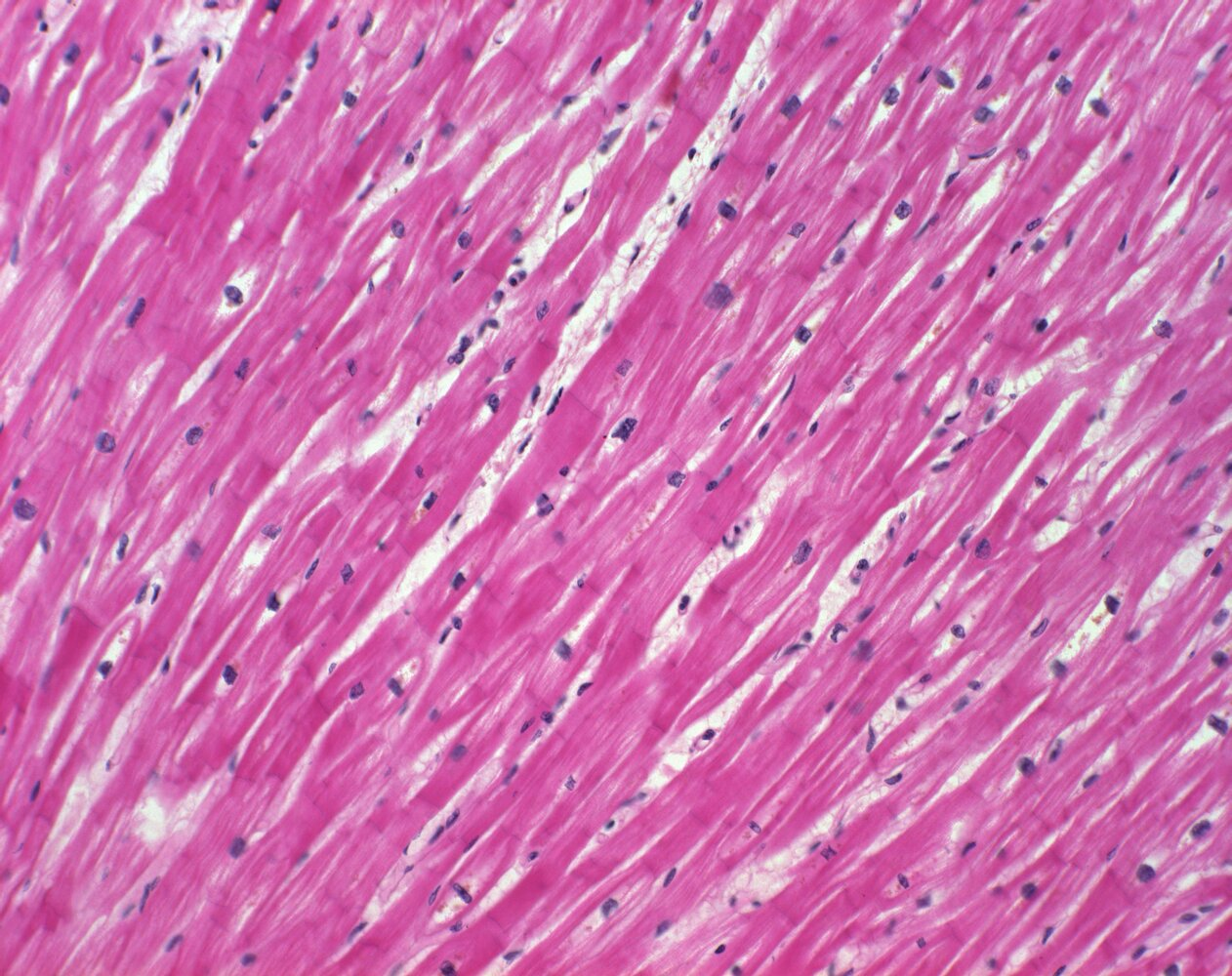 <p>20. The microscopic overview image in the illustration originates from:</p><p>A. The heart</p><p>B. The stratum reticulare of the skin</p><p>C. The organ capsule of the spleen</p><p>D. The tunica muscularis of the stomach</p><p>E. A skeletal muscle</p>