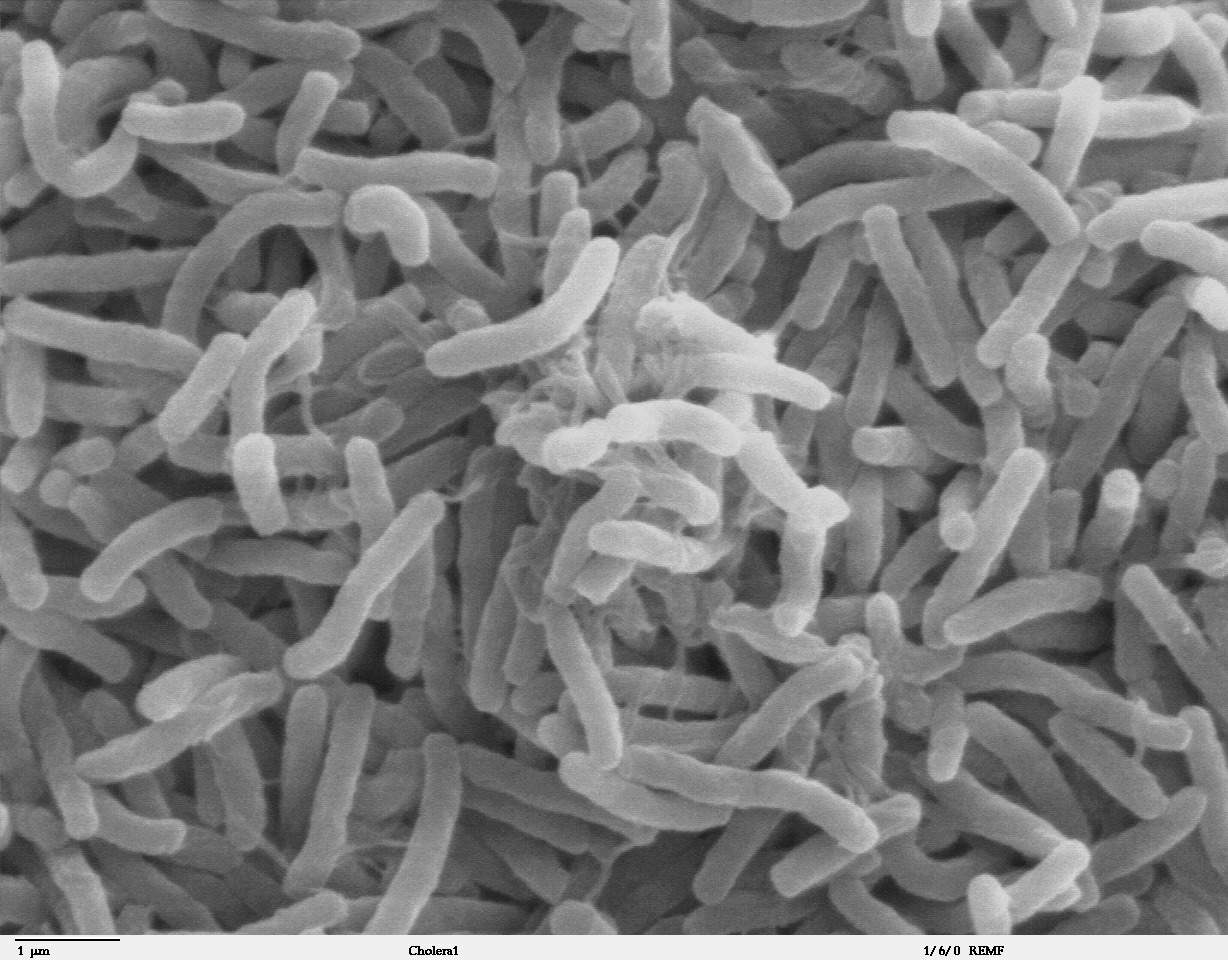 <p>Cholera</p>