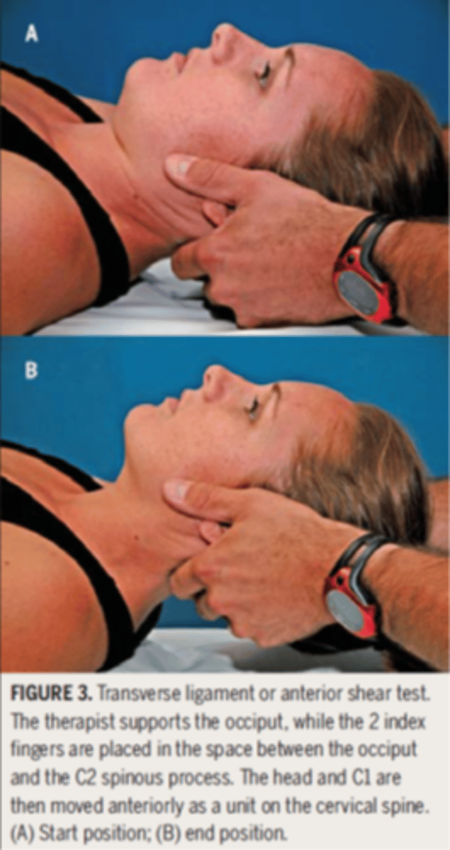 <p>- pt supine with head and neck in neutral</p><p>- PT has both hands supporting occiput with the fingers over the atlas</p><p>- occiput and atlas are translated anteriorly without flexion or extension and held for 15 seconds</p><p>- (+) = end feel is soft or in presence of spasm, nausea, vertigo, paresthesia, nystagmus, or esophageal pressure</p>