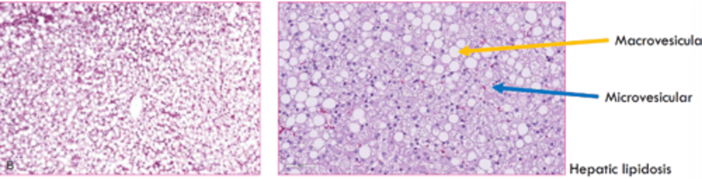 <p>multiple small round clear vacuoles that do not displace the nucleus</p>