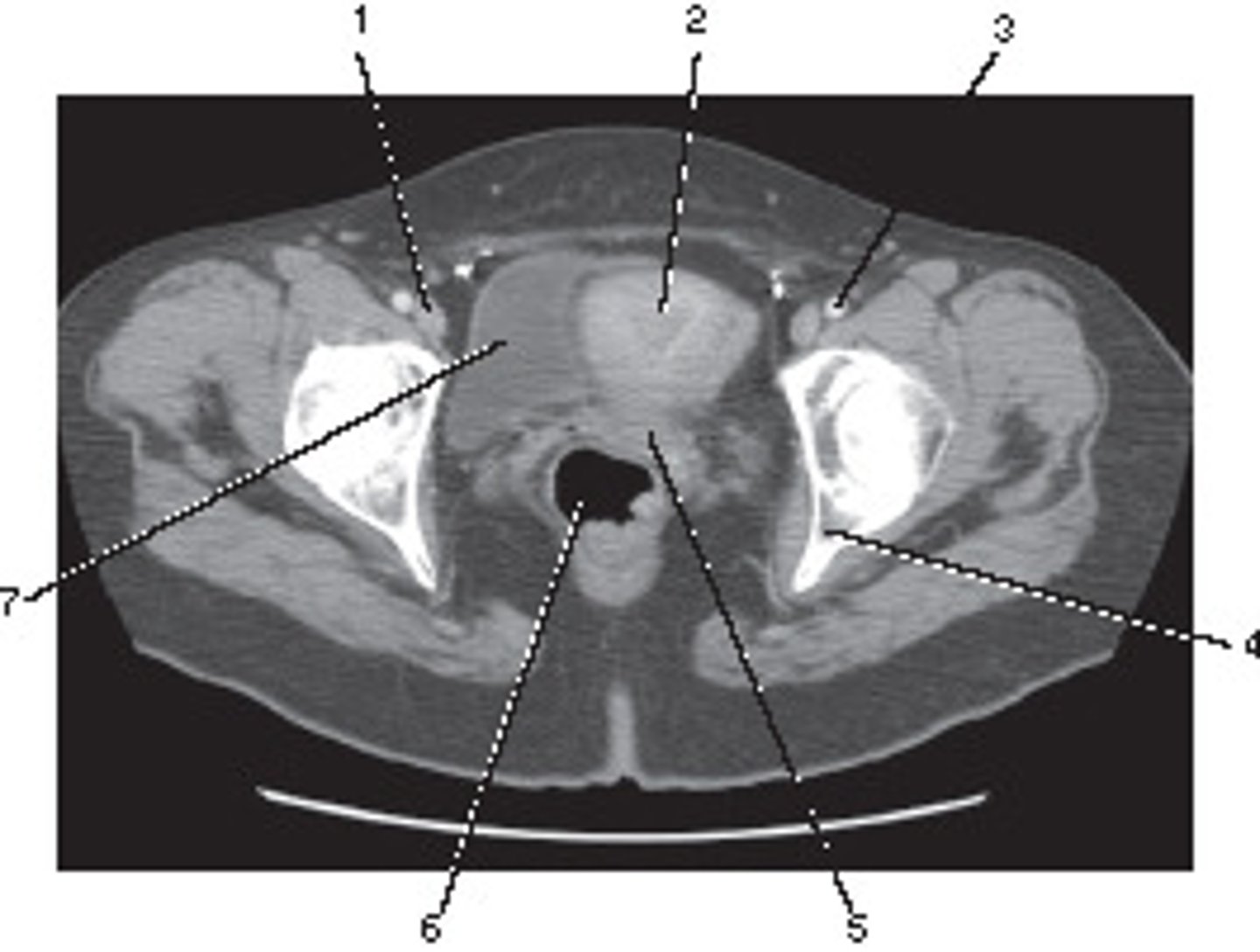 <p>On the basis of the appearance of this image, what contast media was utilized?</p>