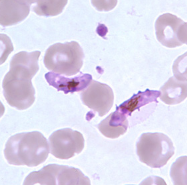 <p>Dr. Vicente Y. Belizario Jr.</p>