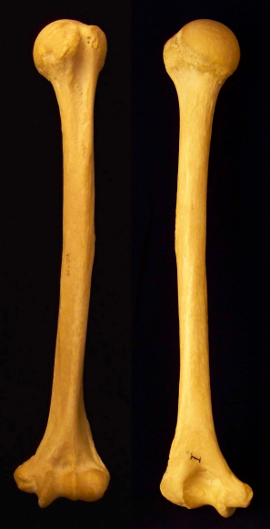 <p>Which bone is shown?</p>