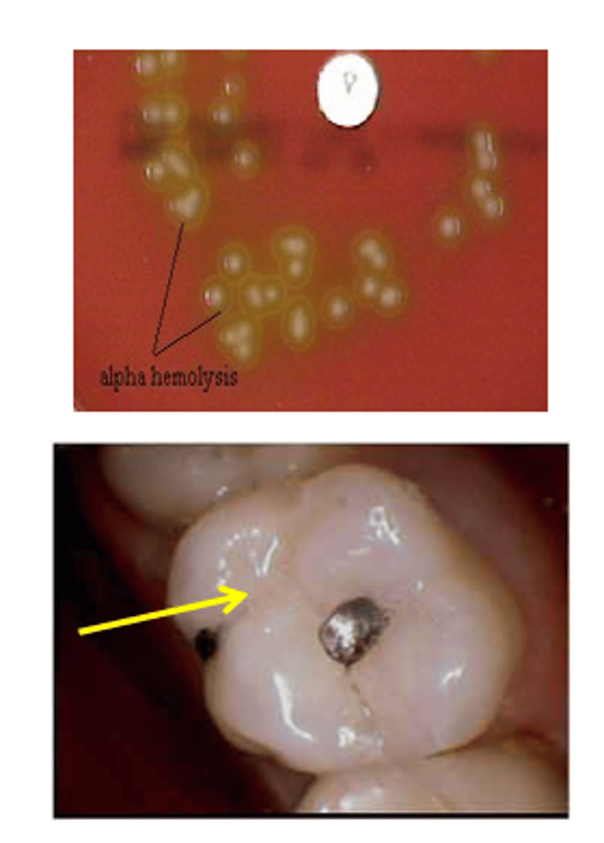 <p>-<strong>Oral viridans strep:</strong> polysaccharide capsule, strong biofilm formation, dextran production (an adhesion that binds fibrin)</p>