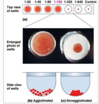 <p>detects IgG in serum, pleural fluid, peritoneal fld, joint fluid</p><p>serum titer 1:2-1:4 = presumptive early infn</p><p>&gt; 1:16 = disseminated infn</p><p>CSF titer 1:2 = meningitis</p><p>cross-reactivity w/ Histoplasma</p><p></p>