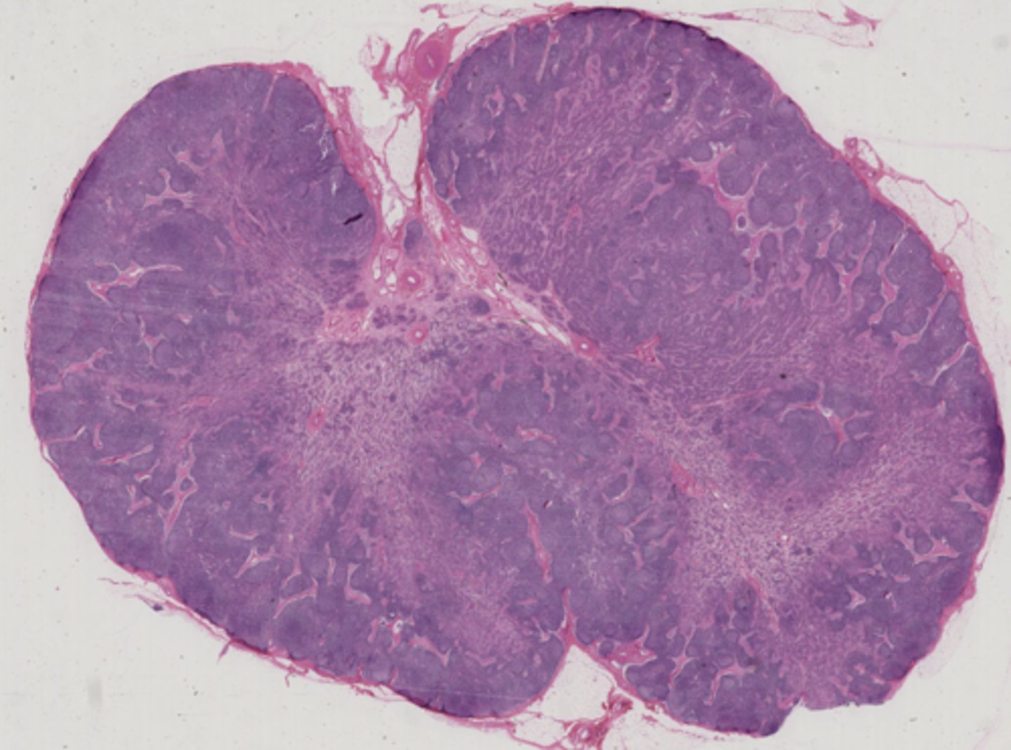 <p>De er placeret rundt i kroppen for at filtere den lymfe der kommer via afferente (tilførende) lymfekar.</p><p>Det er også dem der præsentere antigene peptider for T celler</p><p>De eksponere B celler for intakte antigener.</p>