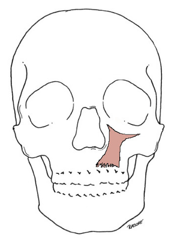 maxillary bone above infraorbital foramen