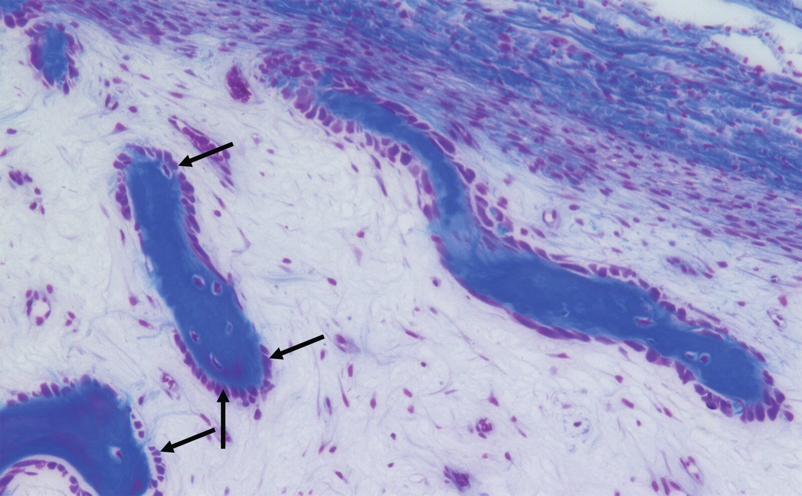 <p>12. The cells marked with arrows in the image:</p><p>A. Typically have multiple nuclei</p><p>B. Are inhibited by calcitriol</p><p>C. Partially differentiate into osteocytes</p><p>D. Are activated by the peptide hormone sclerostin</p><p>E. Are characterized by large lysosomes and vacuoles</p>