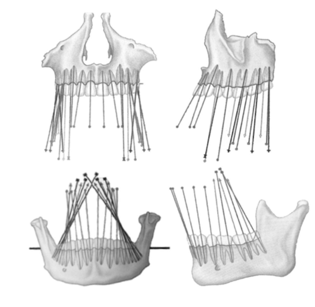 <p>Why is it important to know tooth angulation and inclination?</p>