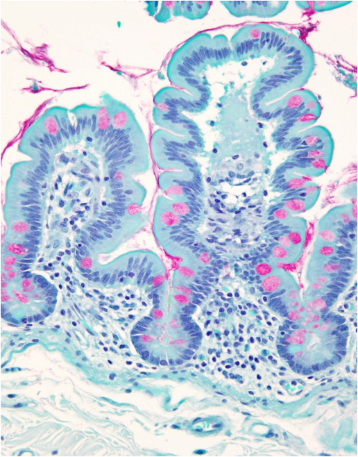 term image