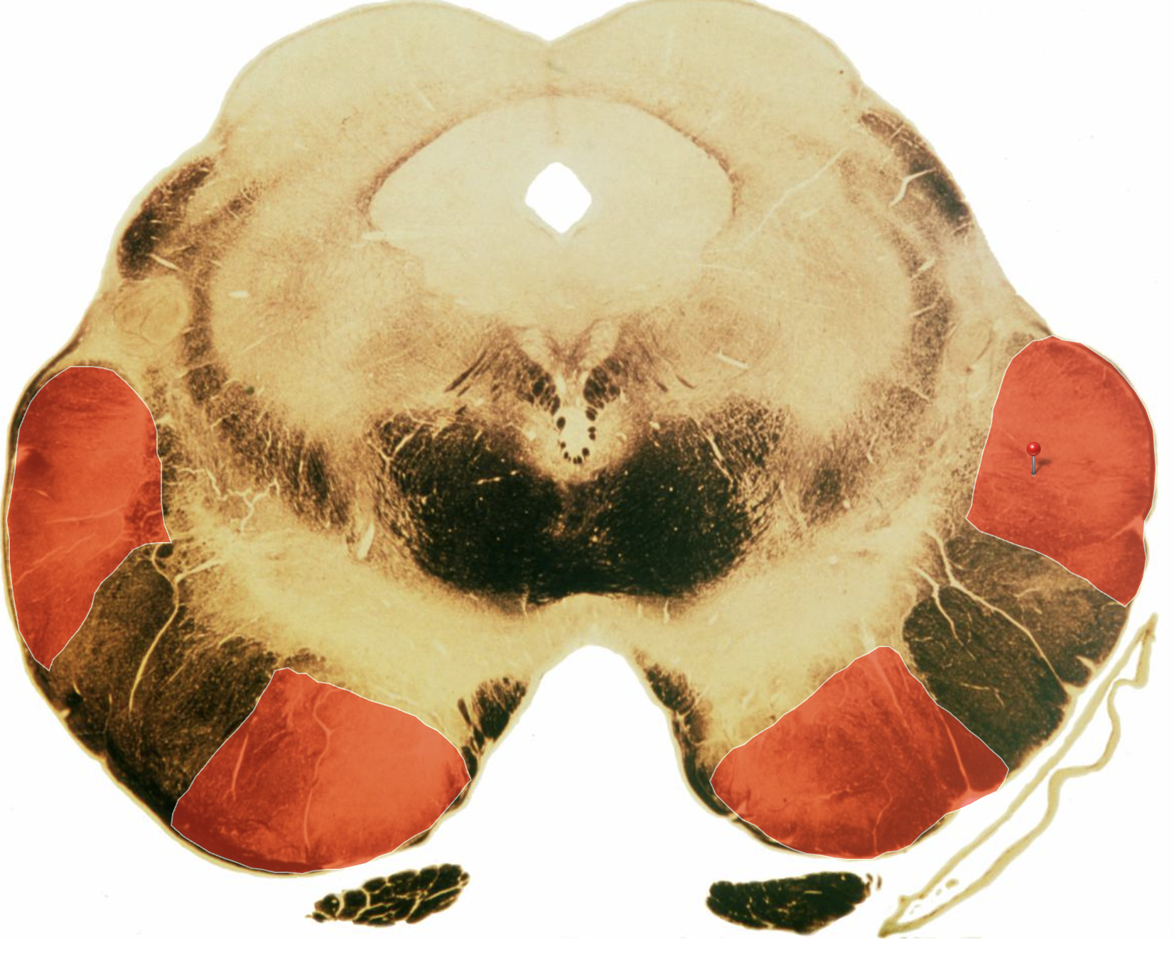 <p>Identify</p>