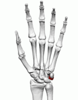 term image
