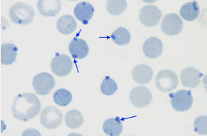 <ul><li><p>round blue structures</p><ul><li><p>denatured hemoglobin</p></li></ul></li><li><p>normal in cats in 5% of RBC</p></li><li><p>increased # indicate diabetes, lymphosarcoma, etc.</p></li></ul><p></p>