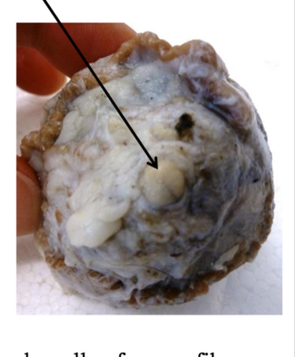 <p>transfer of visual information</p>