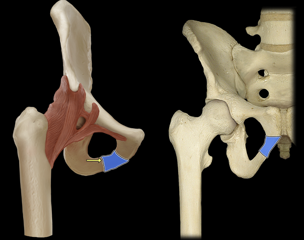 <p>Inferior pubic ramus</p>