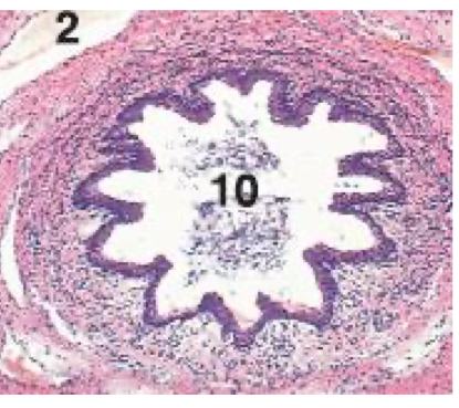 <p>What is the organ is shown in this cross-section?</p>