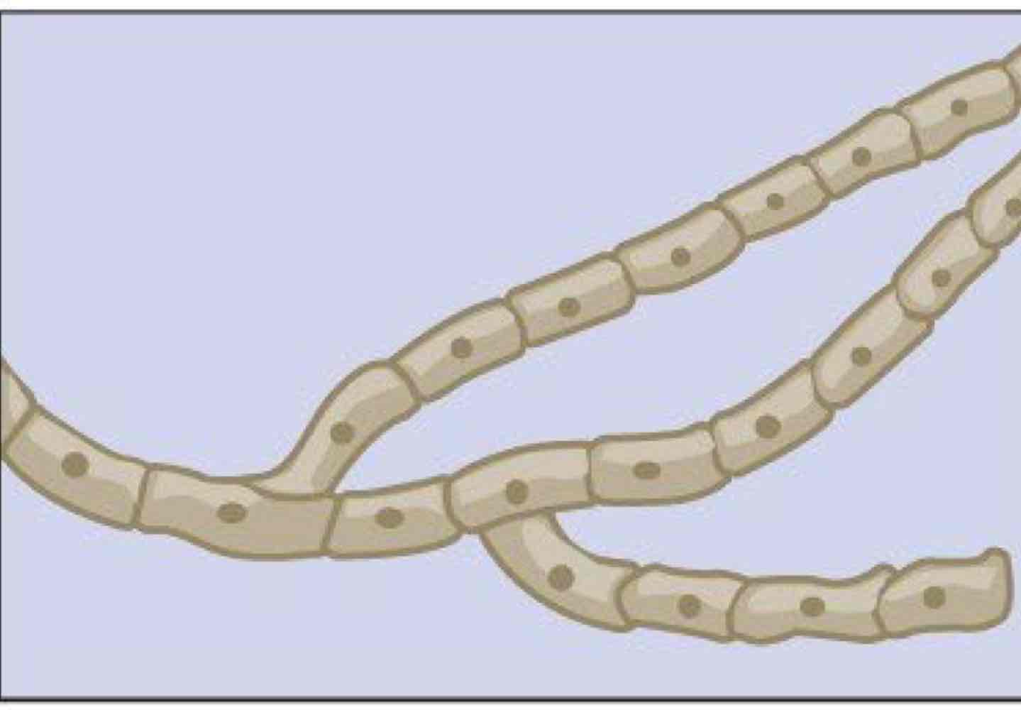 <p>Name this hyphae</p>