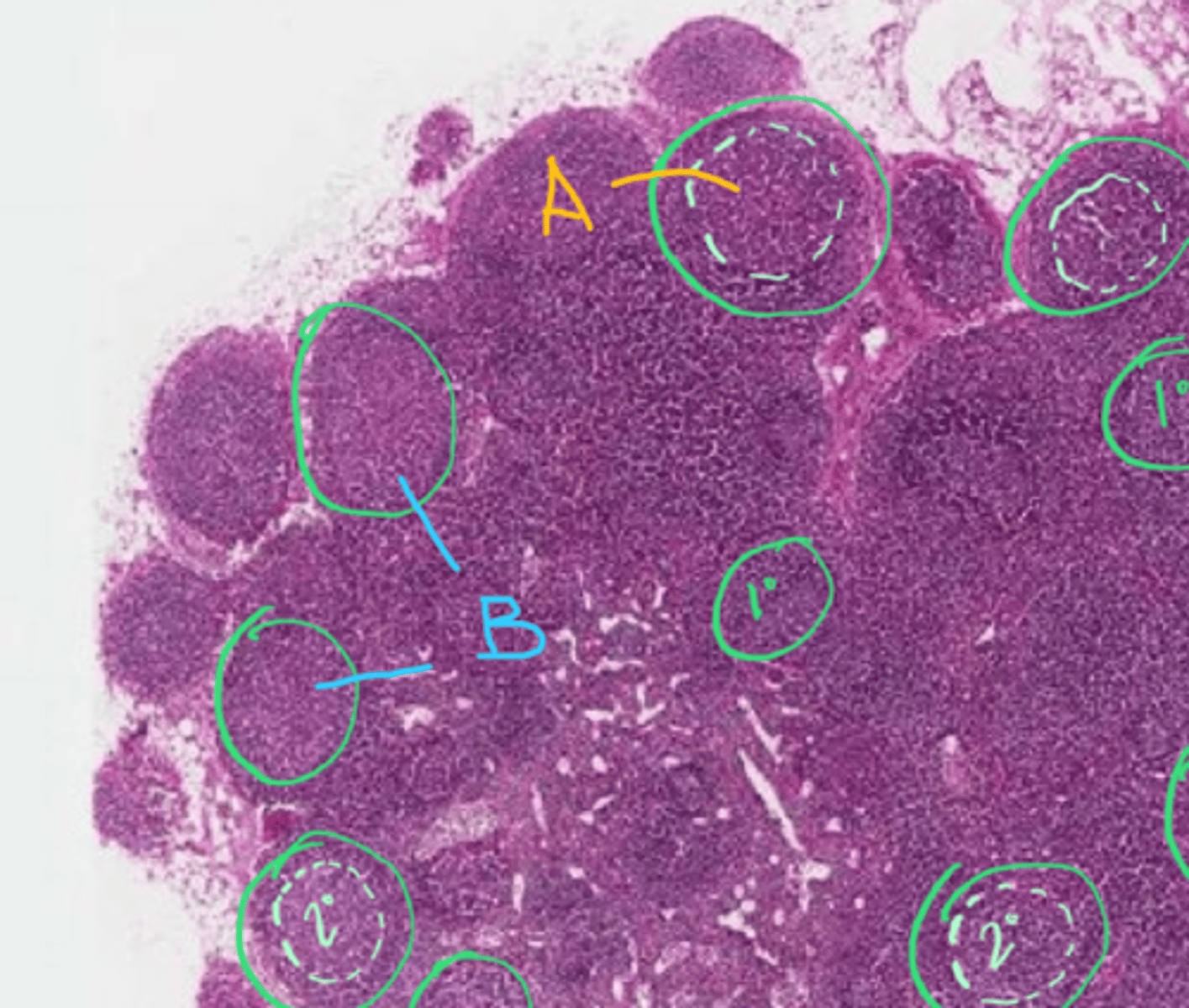 <p>B is a [primary/secondary] lymphoid follicle</p>