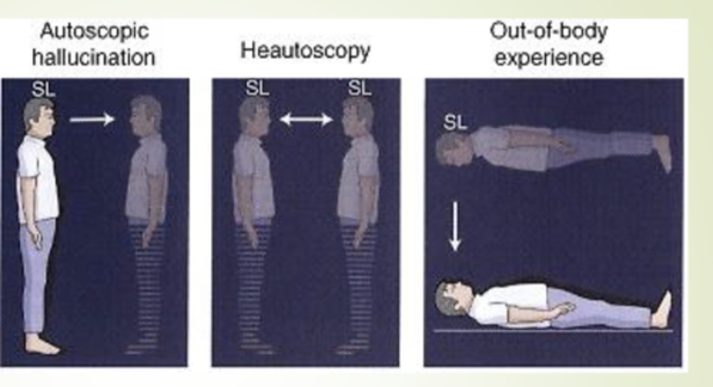 <p>inhabiting another body (usually hovering above); right temporoparietal cortex</p>