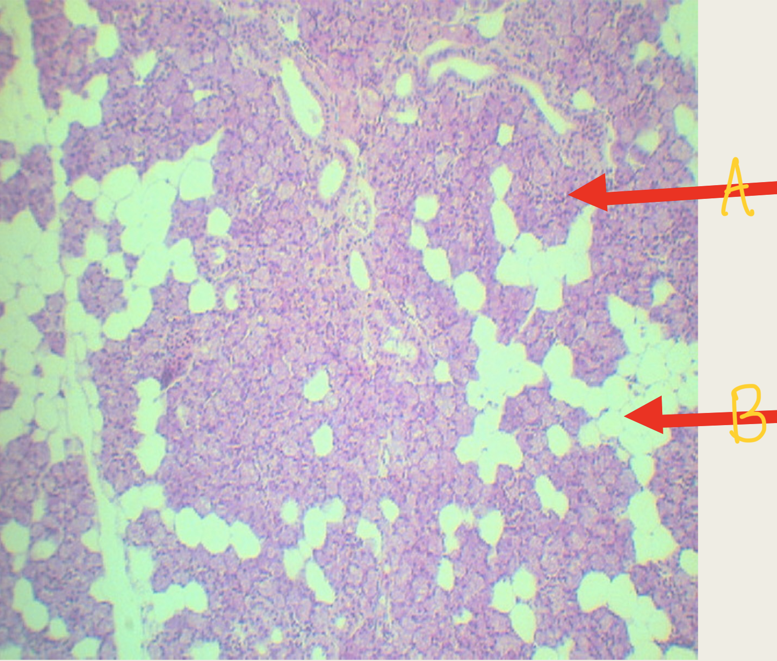 <p>Identify the structure (A is type of gland and secretion)</p>
