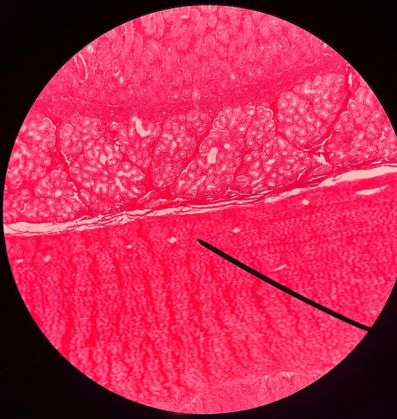• Slide histology of the duodenum.

• The layer of the duodenum deep to the submucosa.