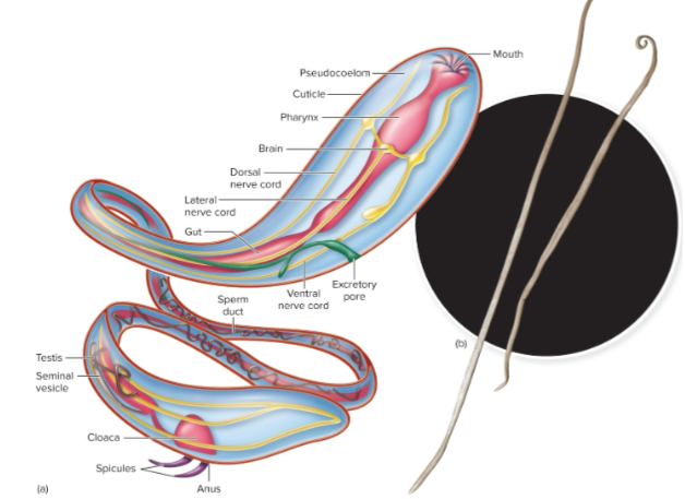 <p><span>Elongated, cylindrical, unsegmented body</span></p>