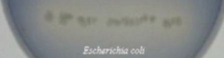 <p>Is this a negative or positive Lipid hydrolysis (Sprit blue agar) test?</p>
