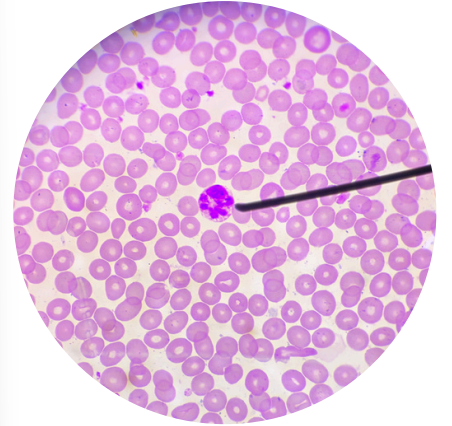 <p>what kind of white blood cells is this?</p>