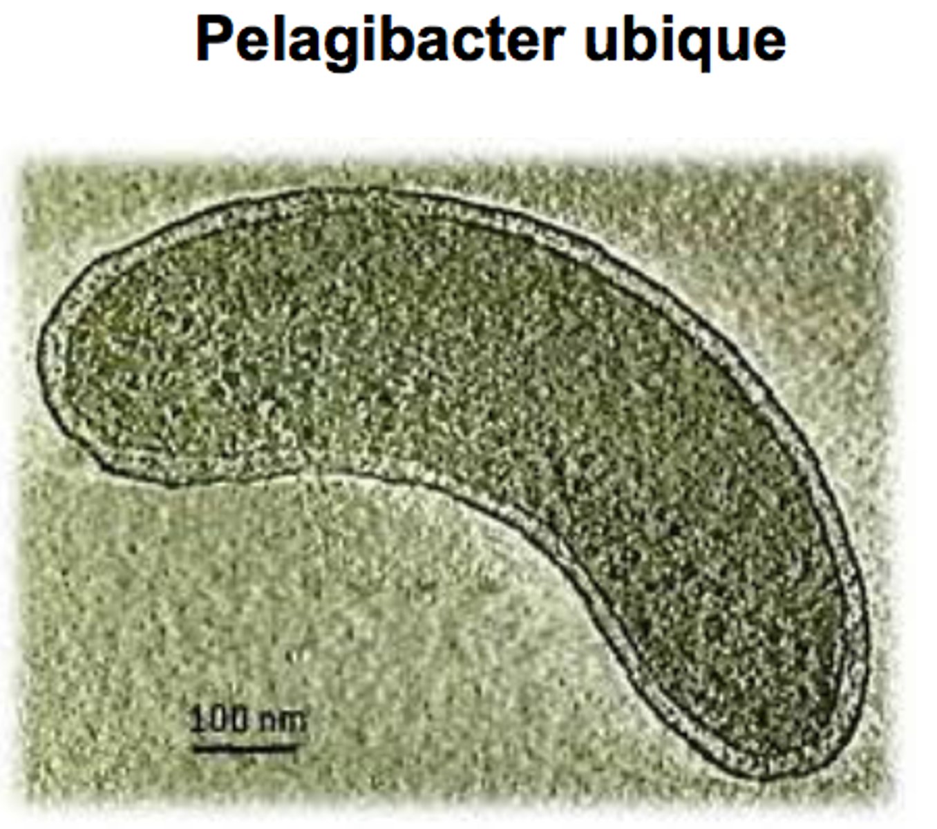 <p>A marine/water bacterium that was only known by its rRNA until the 1990s although this bacterium is makes up one-third of the microbes in the ocean.</p>