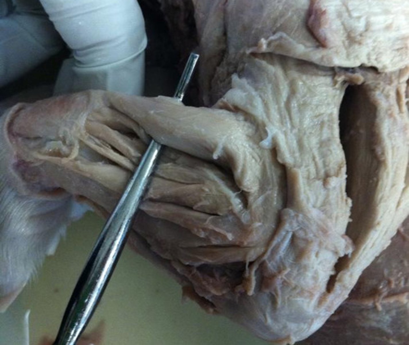 <p>Proximal hindlimb segment providing propulsion — Region between hip and knee</p>