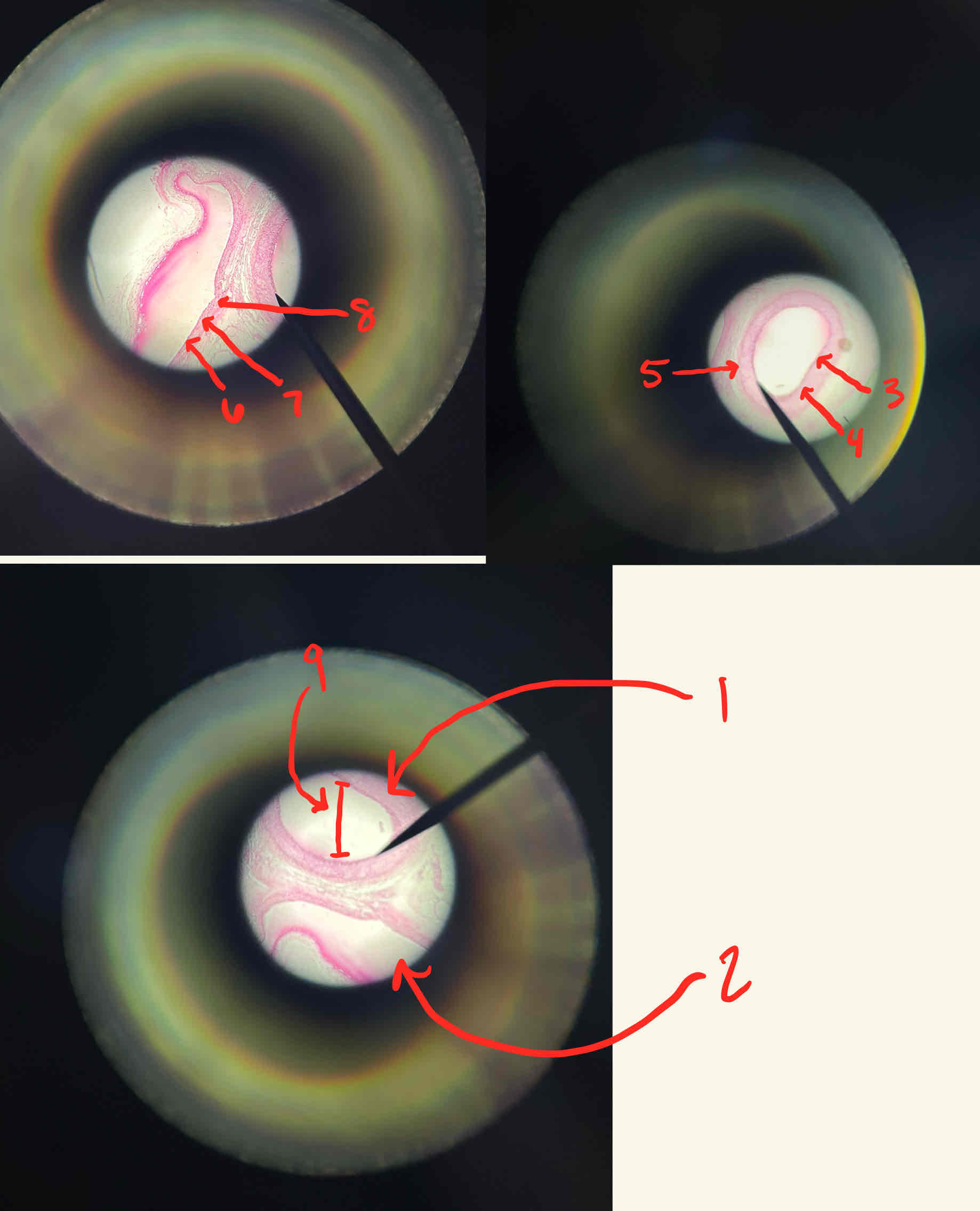 <p>What is the structure labeled 9</p>