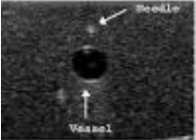<p>What axis is this?</p>