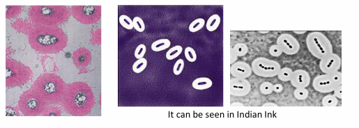 <p>Algunas bacterias también tienen cápsulas que van por fuera del todo (incluido la pared celular) y están hechas de:</p><ul><li><p>polisacáridos</p></li></ul><p>Tinción:</p><ul><li><p>Tinción de tinta china (Indian ink)</p><ul><li><p>Esta no entra dentro de la cápsula y por eso vemos zonas blancas de clarificación</p></li></ul></li></ul><p>Funciones:</p><ul><li><p>Adherencia </p><ul><li><p>Ejemplo: Streptococcus mutants (lo encontramos como causa de las caries en la placa dental)</p></li></ul></li><li><p>Protección de la fagocitosis</p><ul><li><p>Ayuda a evadirse del sistema inmune; tiene un factor de virulencia que le ayuda a evadirse de la fagocitosis</p></li><li><p>Resistente a la desecación</p></li></ul></li></ul><p></p>