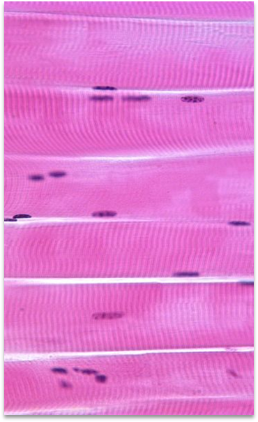 <p>Striated Voluntary muscle</p><p></p><p>In charge of movement</p><p></p><p>“Cruise Control”</p><ul><li><p>Breathing, swallowing, posture</p></li></ul><p></p>