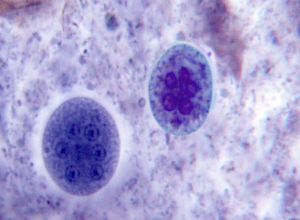 E. coli cyst