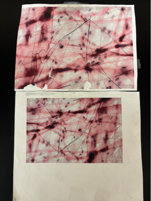 <p>What kind of tissue/cartilage is this?</p>