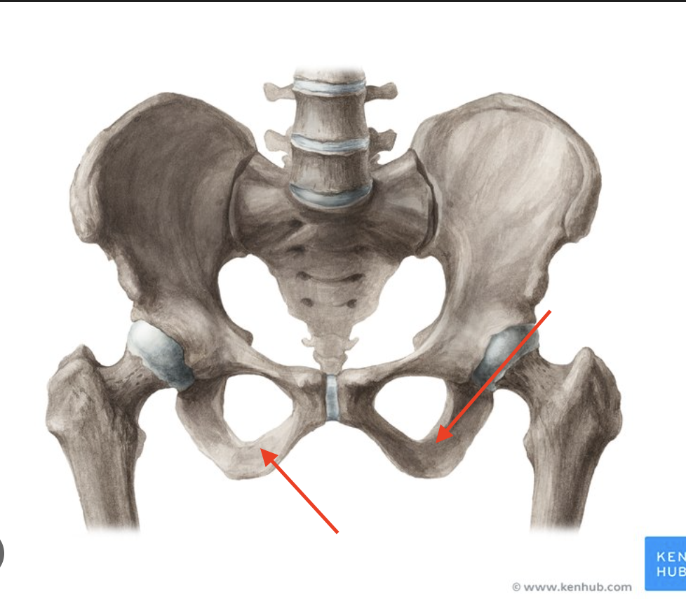 <p>lower bridge over the obturator foramen </p>