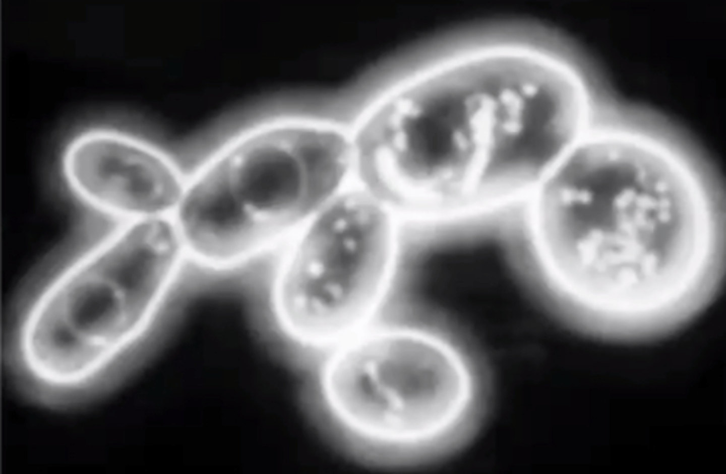 <p>What type of microscopy is shown?</p>