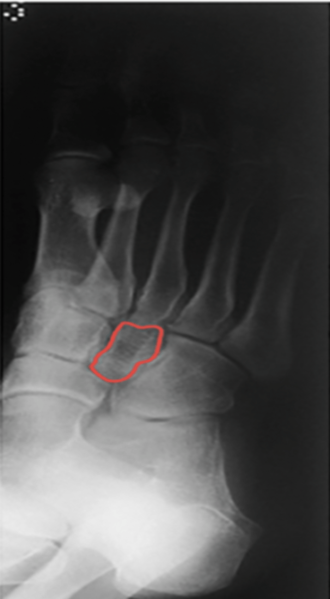 <p>What structure is highlighted?</p>
