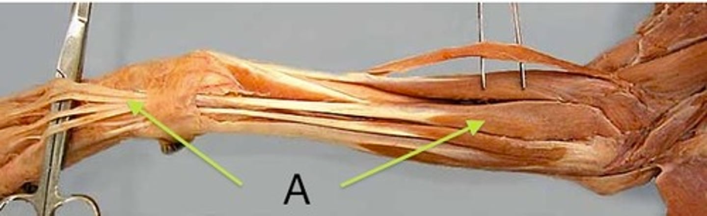 <p>What muscle is this?</p><p>Origin?</p><p>Insertion?</p><p>Action?</p><p>Nerve?</p>
