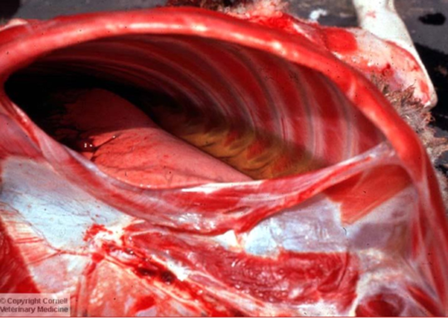 <p>what type of pleural effusion is this?</p>