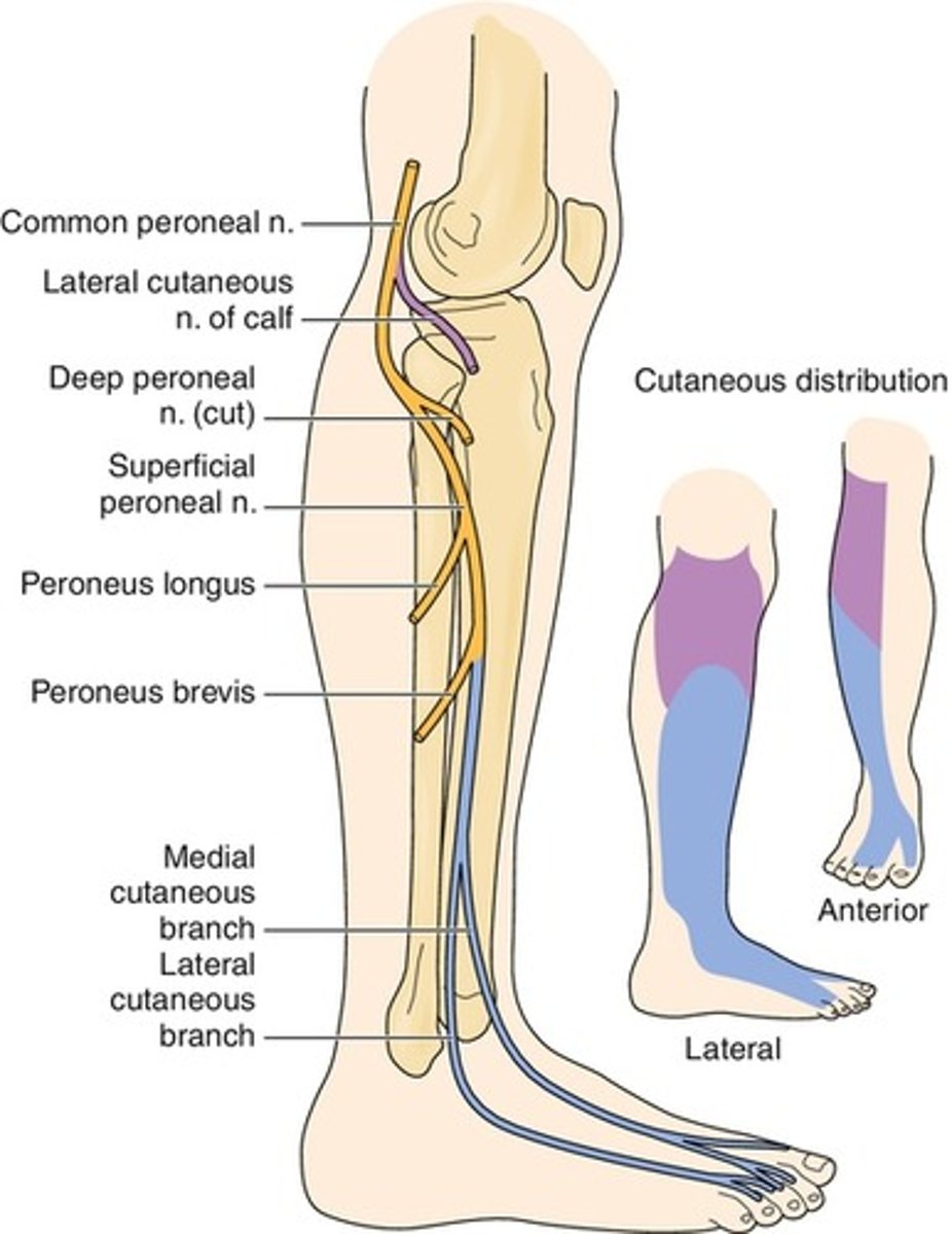 <p>Root: L4-S2</p><p>Cause of injury:</p><p>- trauma or compression of the lateral aspect of the leg, fibular neck fracture</p><p>Presentation:</p><p>- foot drop --> innverted and plantar flexed at rest due to loss of eversion and dosiflexion</p><p>- "steppage" gait</p><p>- loss of sensation on the dorsum of the foot</p><p>Remember:</p><p>- the sciatic nerve innervates the posterior thigh</p><p>- from the sciatic arises both the tibial and the common fibular (peroneal) nerve, which both innervate the lower leg</p><p>- the common peroneal emerges from the posterior thigh, wraps around the neck of the fibula at the lateral head then innervates the anterior surface of the lower leg</p><p>- the tibial nerve innervates the posterior lower leg</p><p>NOTE:</p><p>- the superficial peroneal gives off branches that provide sensory innervation to the dorsum of the foot and lateral shin</p><p>- deep peroneal provides sensory innervation only to the region between the first and second digits of the toe</p>