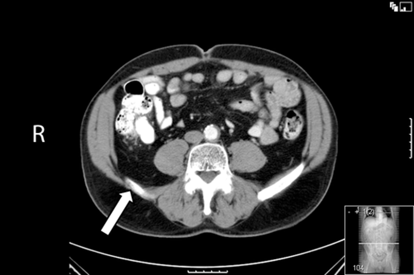 <p>What is indicated in the image?</p>
