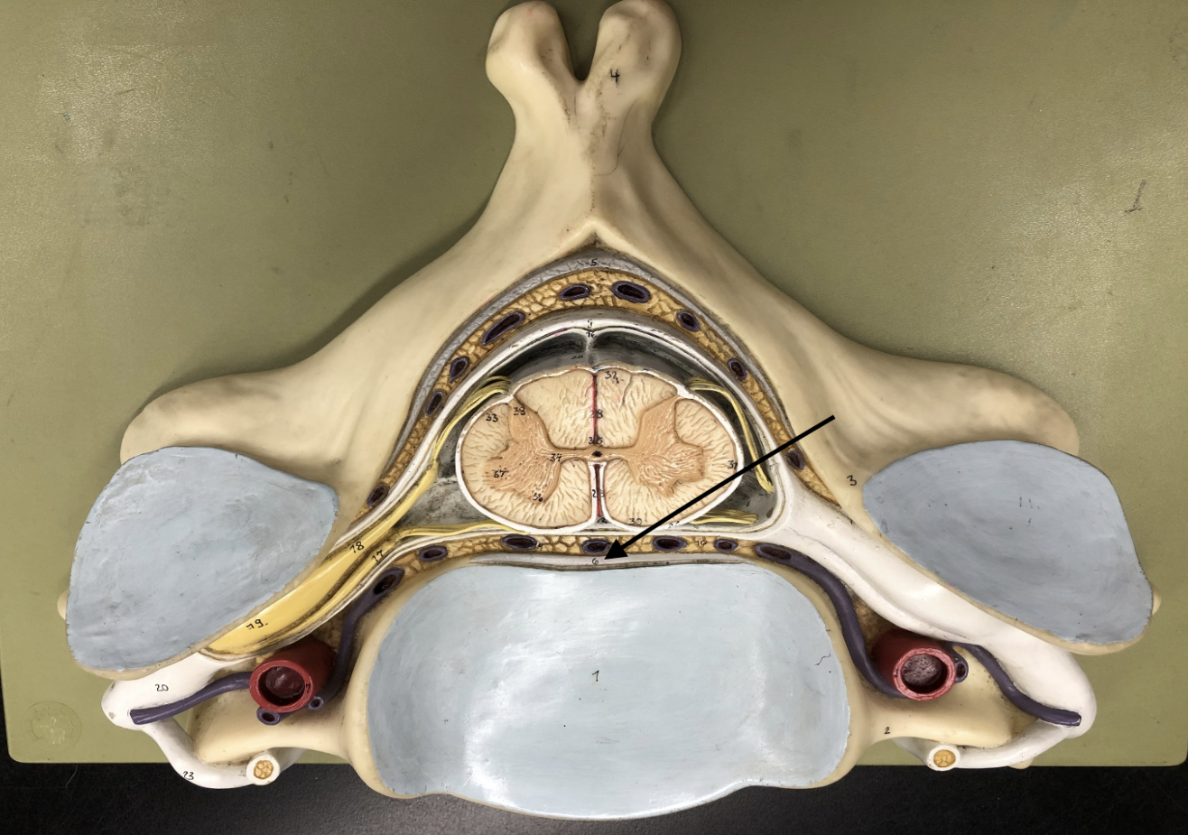 <p>what is this part of the vertebrae (of the spinal cord?)</p>