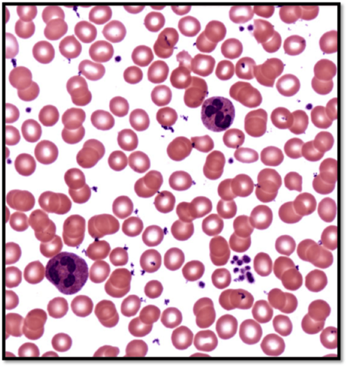 <p>- composed of mostly formed elements suspended in a liquid ground substance called plasma</p><p>- red and white blood cells in a fluid matrix</p><p>- function is the transport of respiratory gases, nutrients, wastes, and other substances</p><p>- contained within the blood vessels</p>