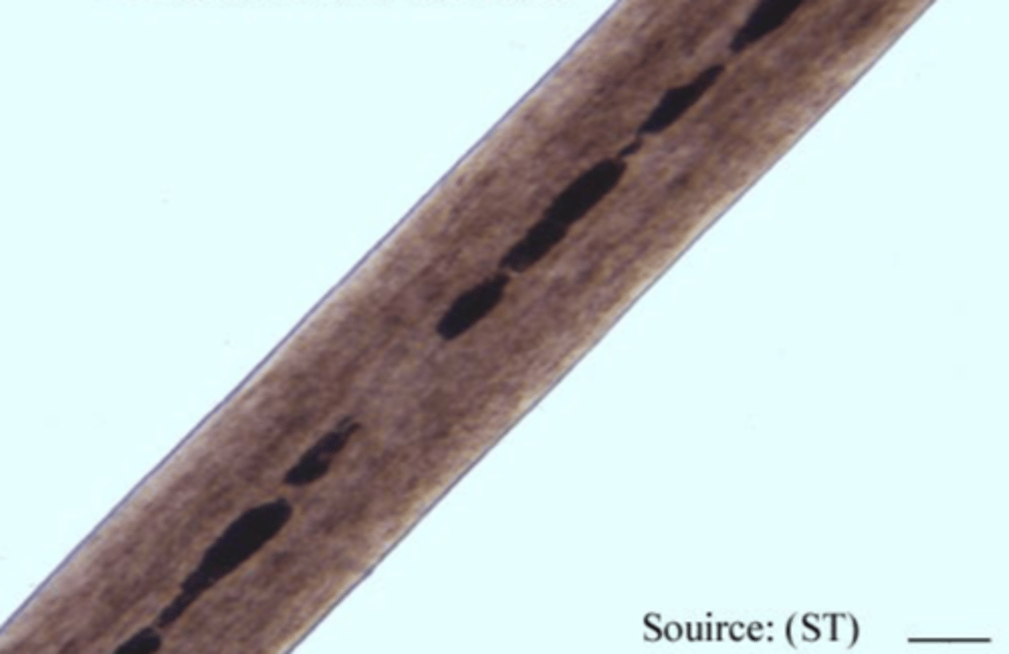 <p>Discontinuous</p>