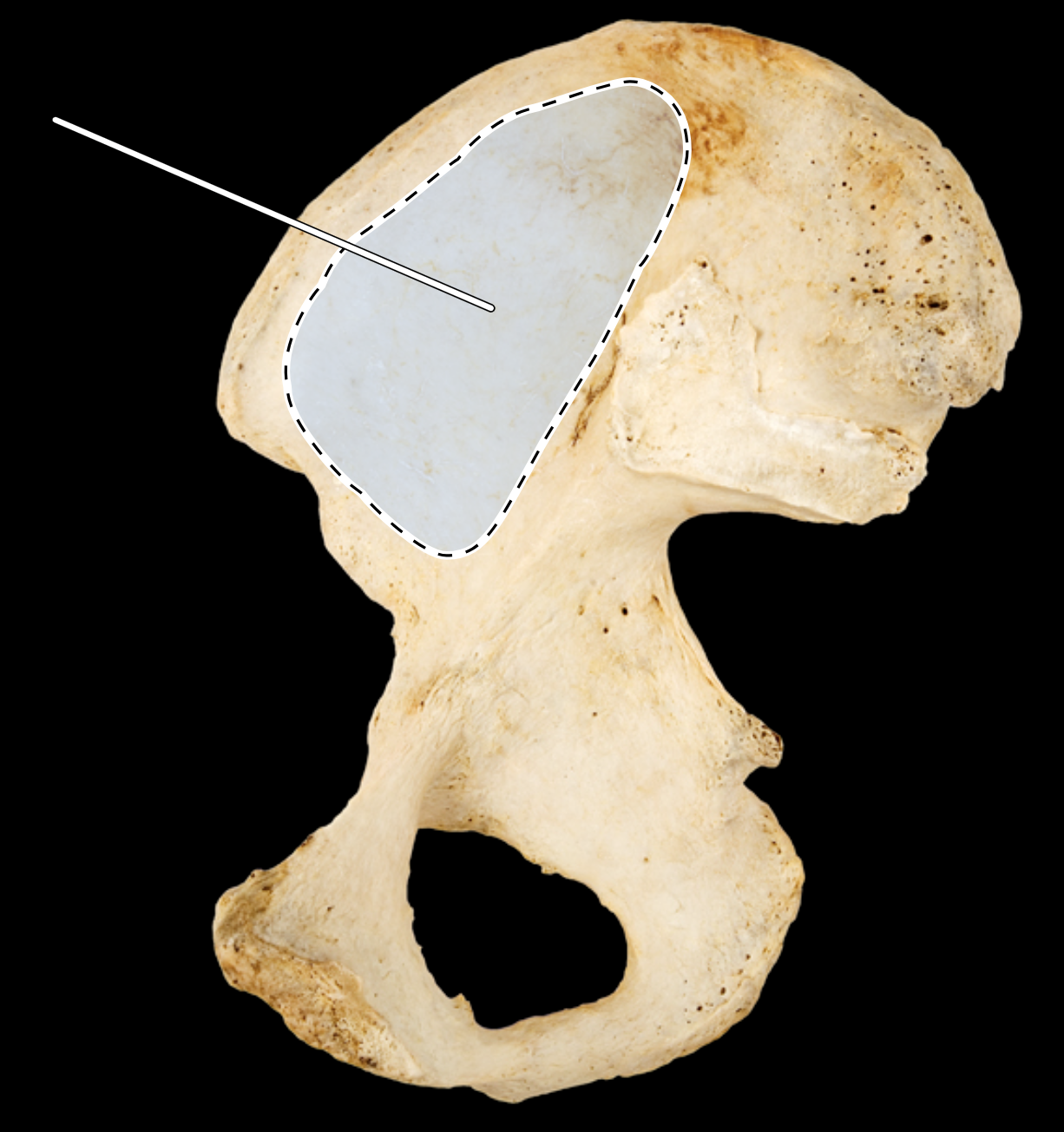 <p>Name the highlighted portion.</p><p>(Hip bone, medial view, right side).</p>