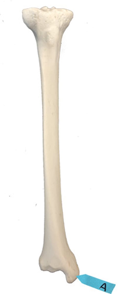 <p>Identify this bone marking.</p>