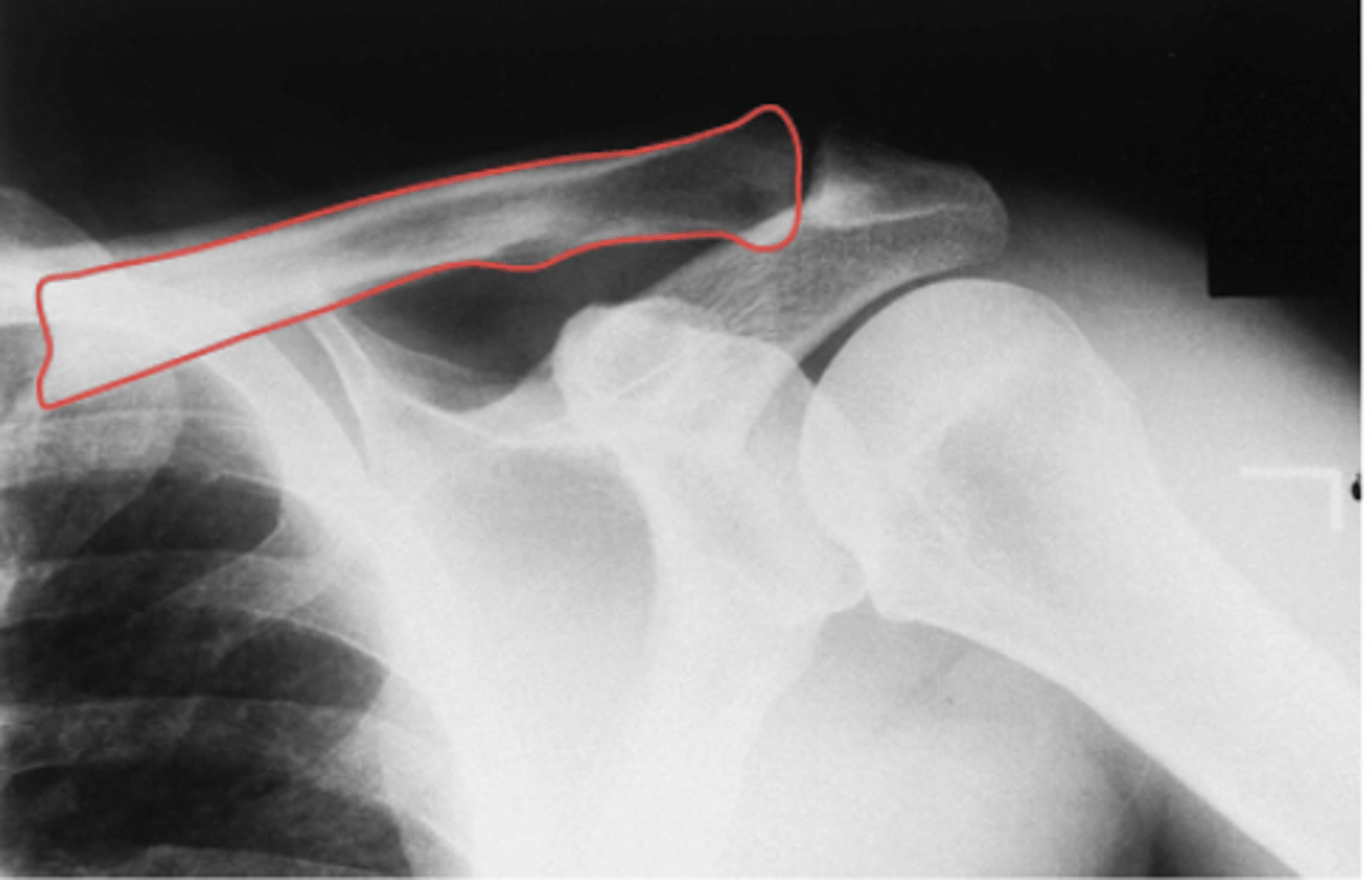 <p>What structure is highlighted?</p>