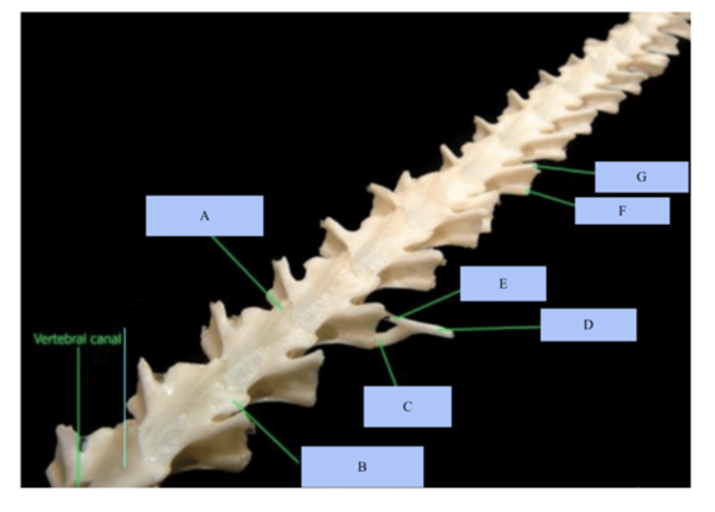 <p>what class of vertebrae is this?</p>
